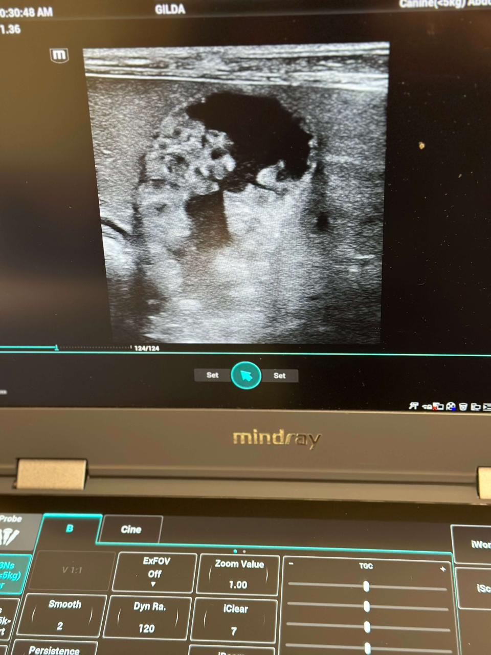 ultrasound